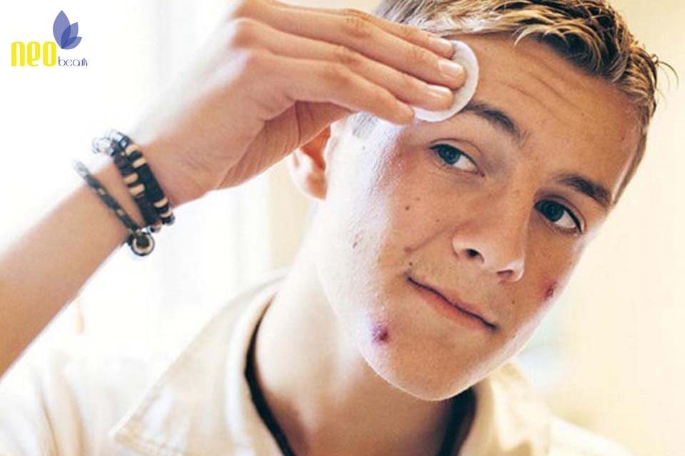 nguyen nhan day mun o nam 1