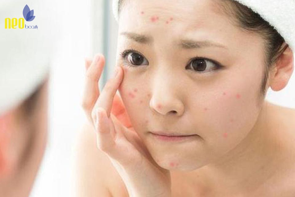 nguyen nhan khien da nhay cam 2