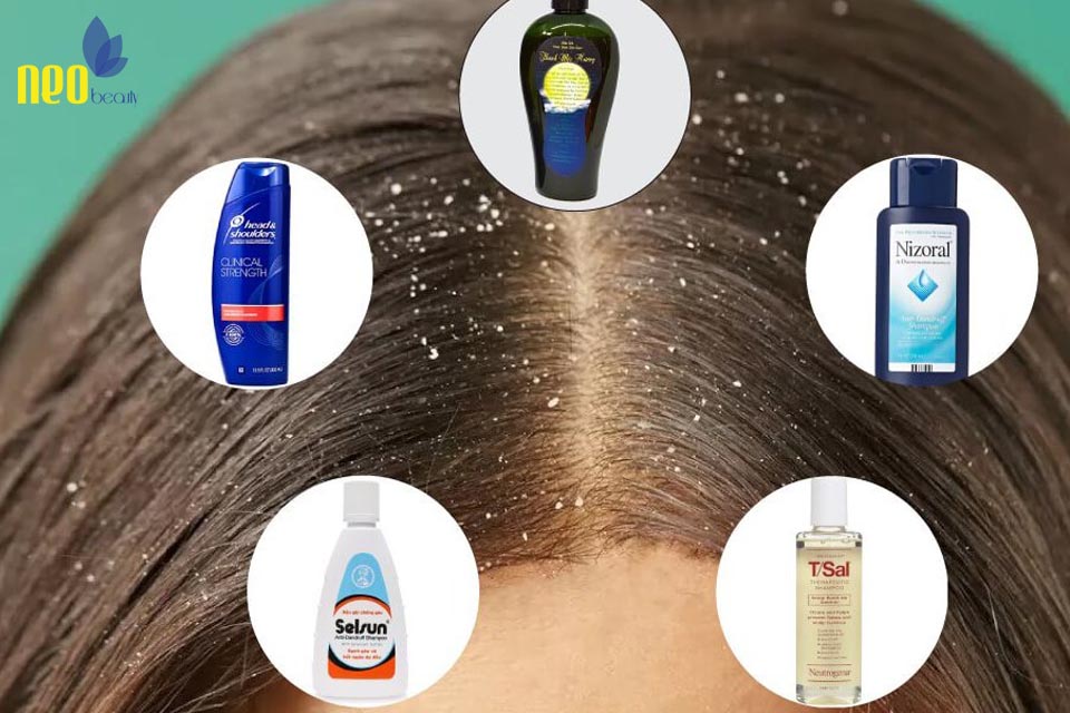 cach tri gau hieu qua 8