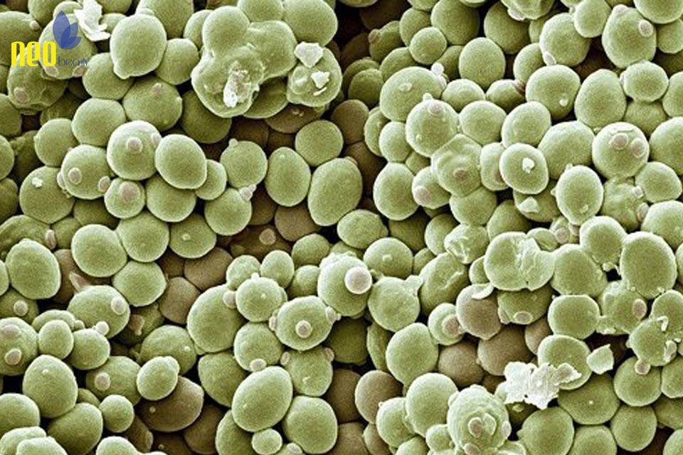 nguyen nhan gay gau 4